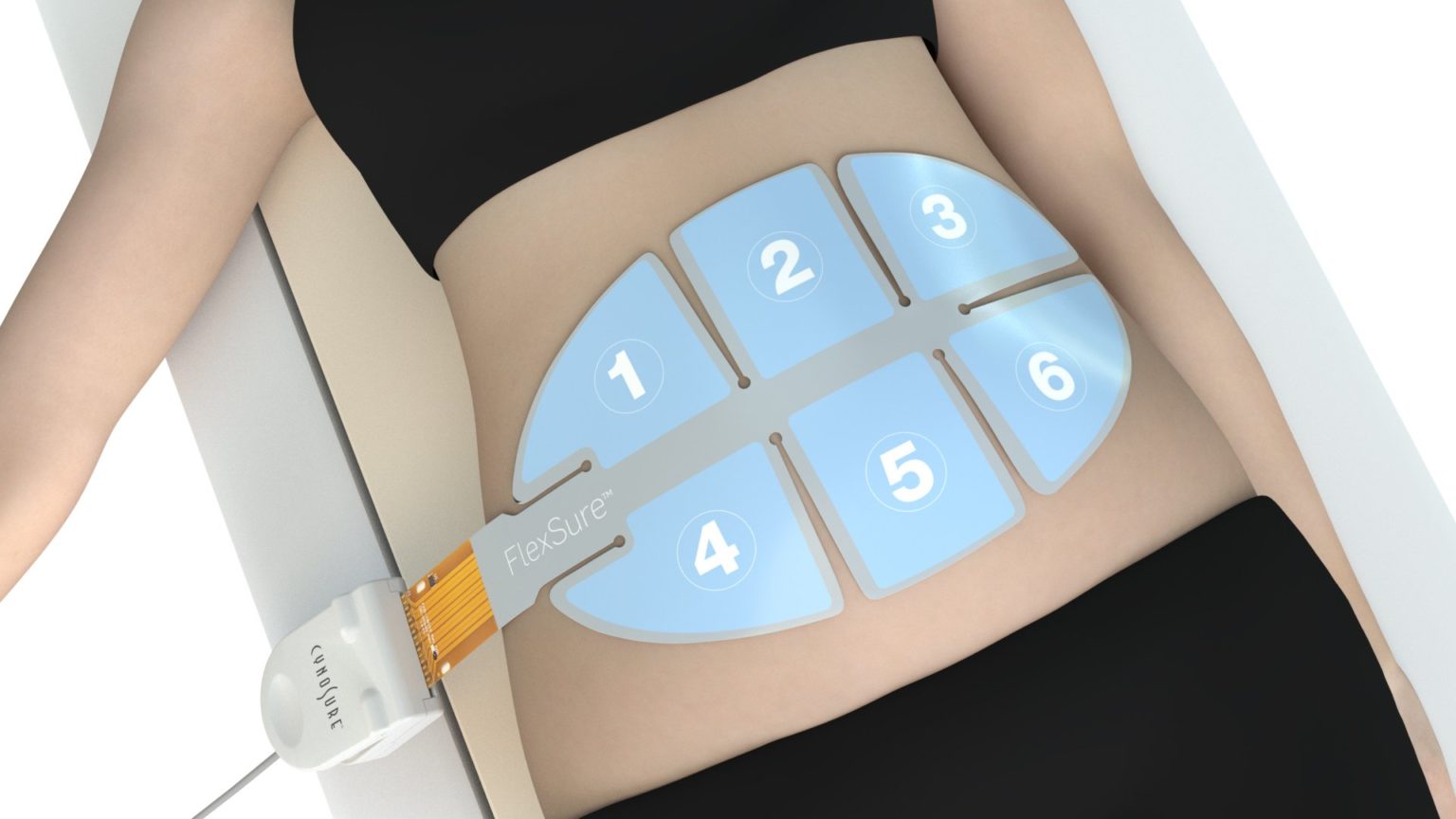 FlexSure™ Cynosure