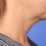 snatched-jawline_test-b