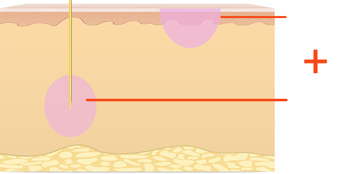illustration-potenza-ultra-2